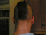 The back