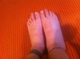 A little swollen